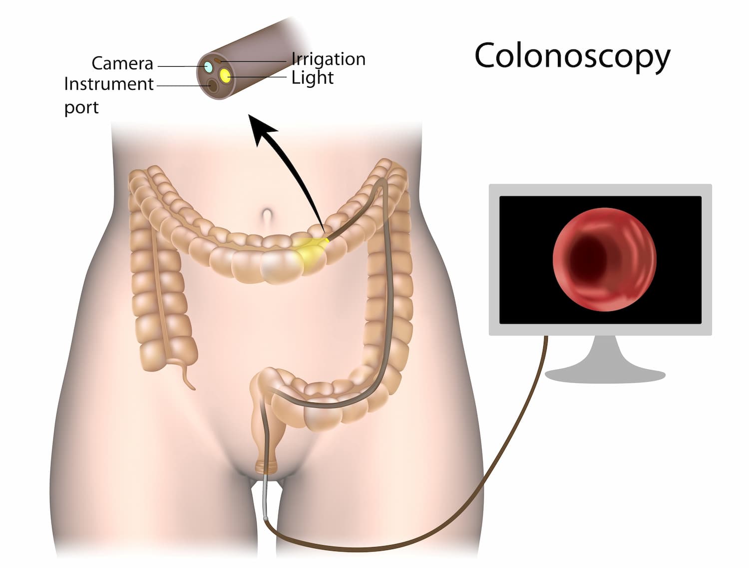 colonoscopy near me cost